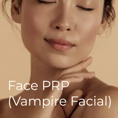 vampire facial